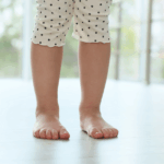 Bradavice u detí: čo funguje a čo určite nerobiť